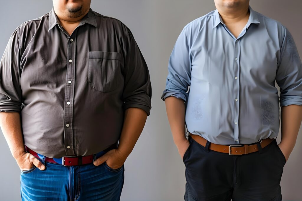 Before and after weight loss transformation